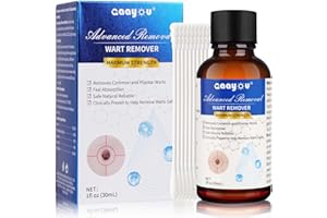Gaayou Wart and Mole Removal Salicylic Acid Liquid Wart Remover Maximum Strength Skin Tag Remover Freeze Off Fast Action for Callus, Corn, Planters, Common Warts 30ml