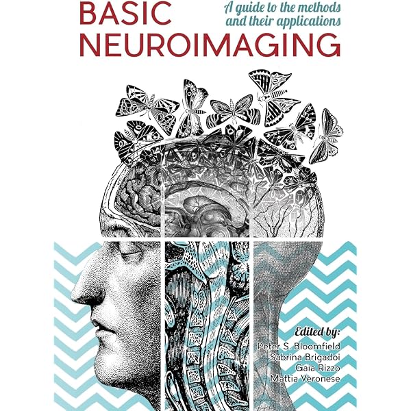 Modern fMRI: Practical Lessons and Insights (Neuroimaging Methods