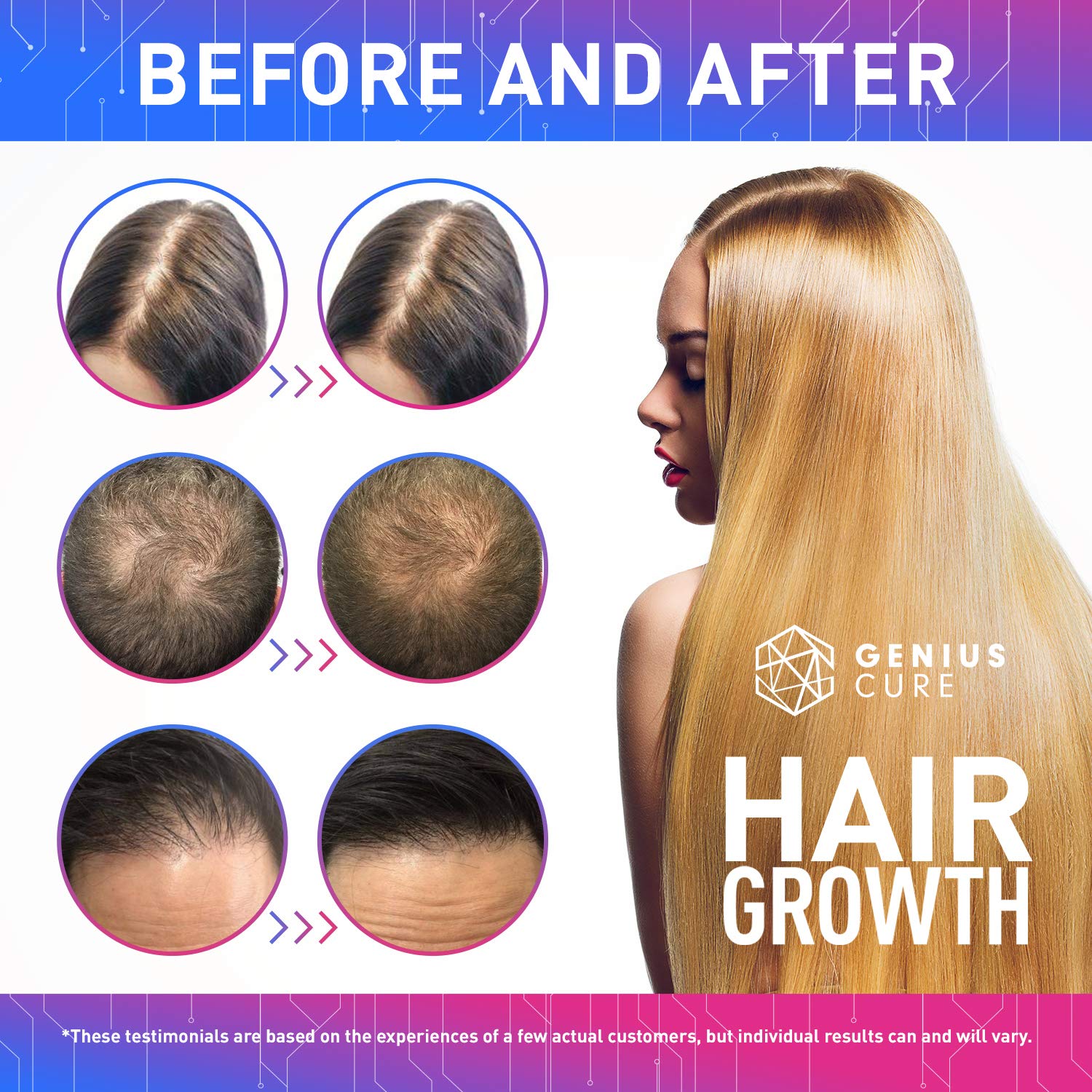 Hair Growth Serum, Hair Growth Treatment, Hair Serum, Hair Loss & Hair Thinning Treatment, Hair Growth Oil Biotin for Stronger, Thicker, Longer Hair 1oz : Beauty