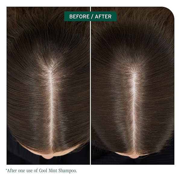 BIOLAGE COOLING MINT SCALP SYNC SHAMPOO | CLEANSES EXCESS OIL FROM THE HAIR & SCALP | FOR OILY HAIR & SCALP | COOL SENSATION | CRUELTY FREE | VEGAN | SALON SHAMPOO | 33.8 FL. OZ