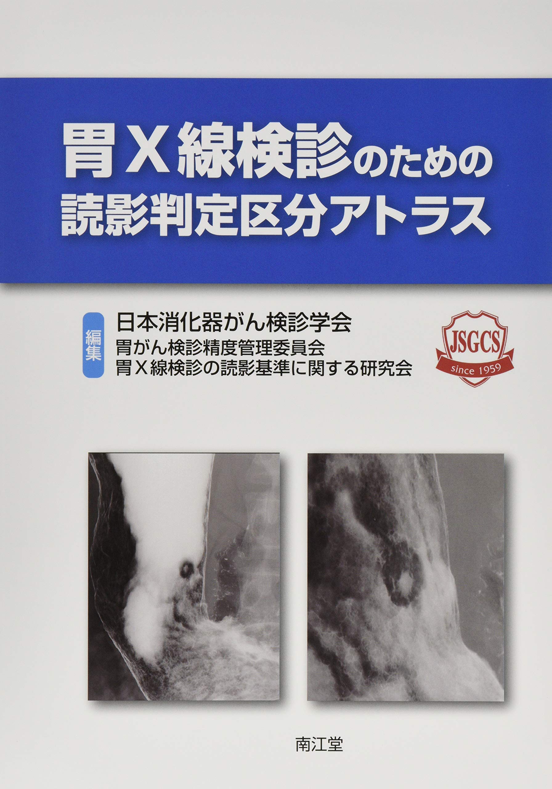 胃x線検診のための読影判定区分アトラス 日本消化器がん検診学会胃がん検診精度管理委員会 胃x線検診の読影基準に関する研究会 本 通販 Amazon