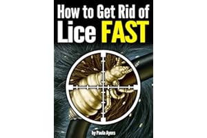 How to Get Rid of Lice FAST: An Essential Guide to Getting Rid of Head Lice for Good