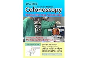Dr. Carl's Colonoscopy insertion method