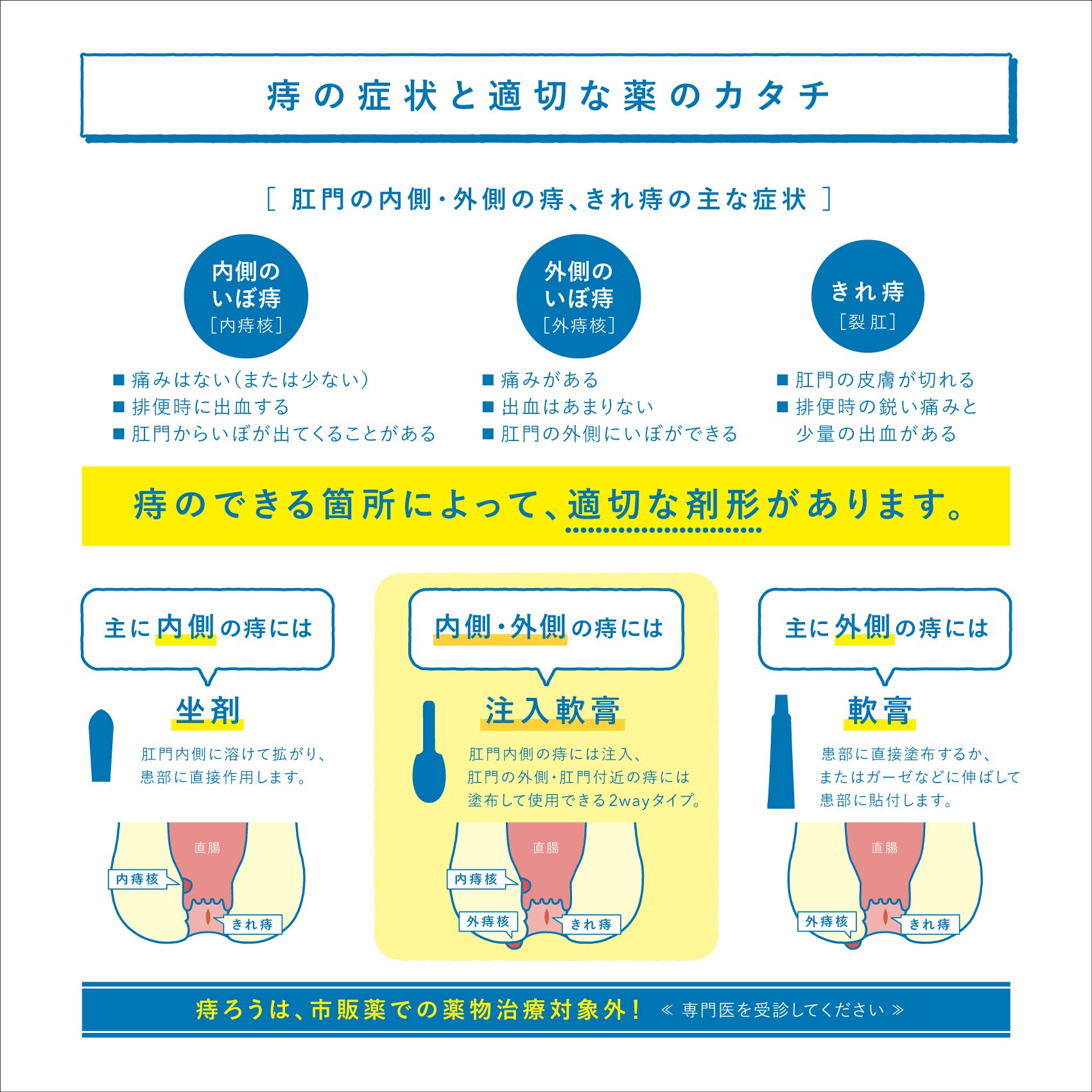 ボラギノール A 注入 軟膏 ボラギノールaとm 坐剤 注入軟膏 の成分 効果の違いと使い方
