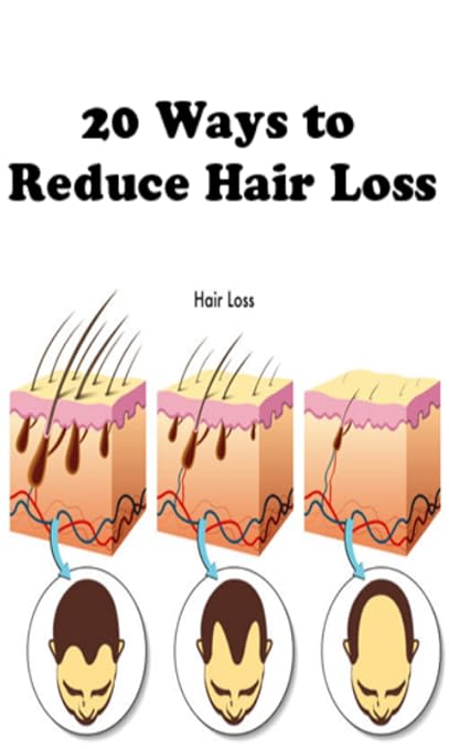 Amazon Com 20 Ways To Reduce Hair Loss Appstore For Android