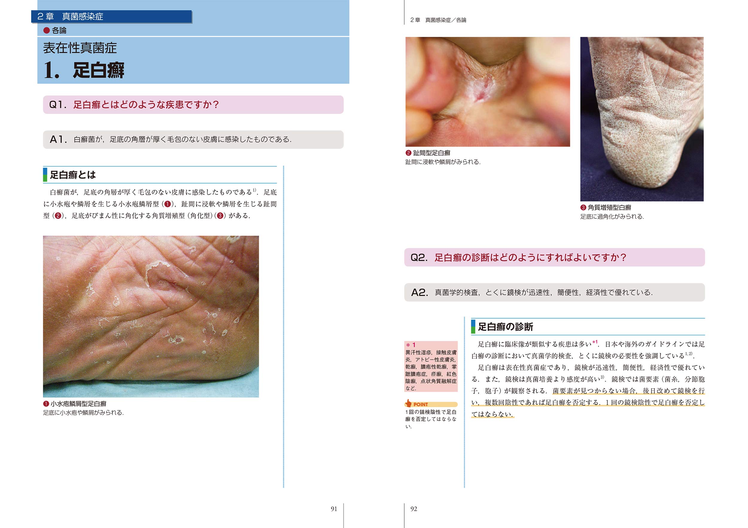 エビデンスに基づくq Aでわかる皮膚感染症治療 Amazon Com Books