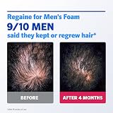 Regaine For Men Extra Strength Foam Hair Loss 5% Minoxidil Regrowth 73ml view 5