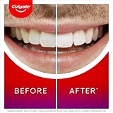 Colgate Max White Ultimate Overnight Teeth Whitening Pen 2.5ml 35 Treatments view 5