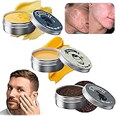 3Pcs Organic Acne and Redness Relief Balm, Organic Acne & Redness Killer, Clearing Cream, Acne Balm, Remove Skin Care Set for All Skin Types