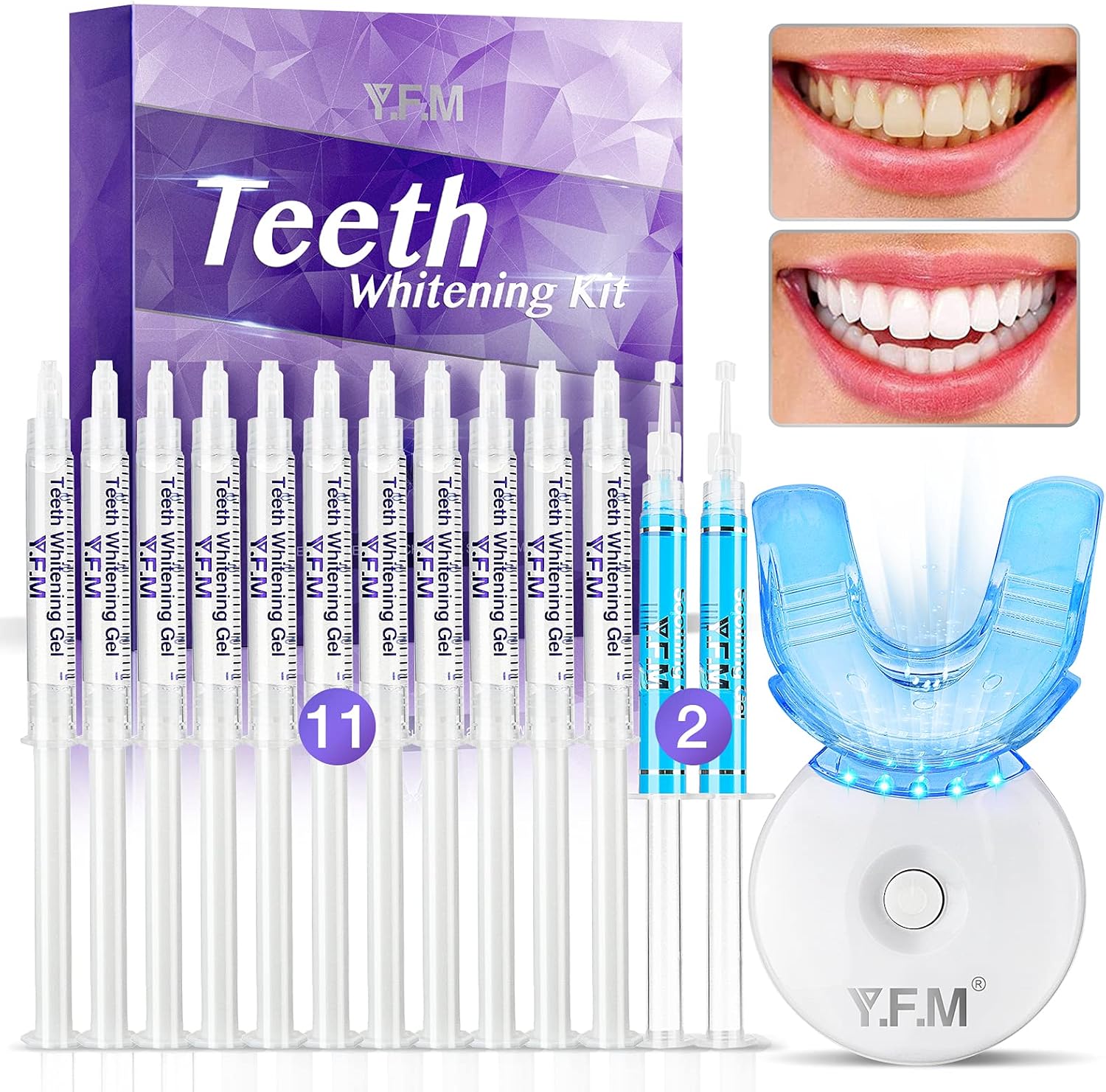 Teeth Whitening Kit, Y.F.M Professional Home Whitening Teeth Kit, 11pcs Teeth Whitening Gel, 2pcs Soothing Gel, 5X LED Light Tooth Whitener, 10 Min Non-Sensitive Fast Teeth Whitener: Health & Personal Care