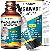 OJIOG Skin Tag Removal Kit - 17% Wart Liquid with Salicylic Acid, Fast-Acting Wart Eliminator for Men & Women, Effective Freeze Off Treatment for Plantar, Flat, Common, Corn, and H Warts (30 ML)