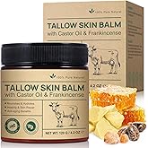 Tallow Frankincense Balm for Face/Body, 100% Grass-Fed Beef Tallow & Castor Oil & Frankincense Oil Moisturizer for Deeply Hydrating/Skin Barrier Repair/Lifting/Firming, Natural,4.2 Oz/120 G