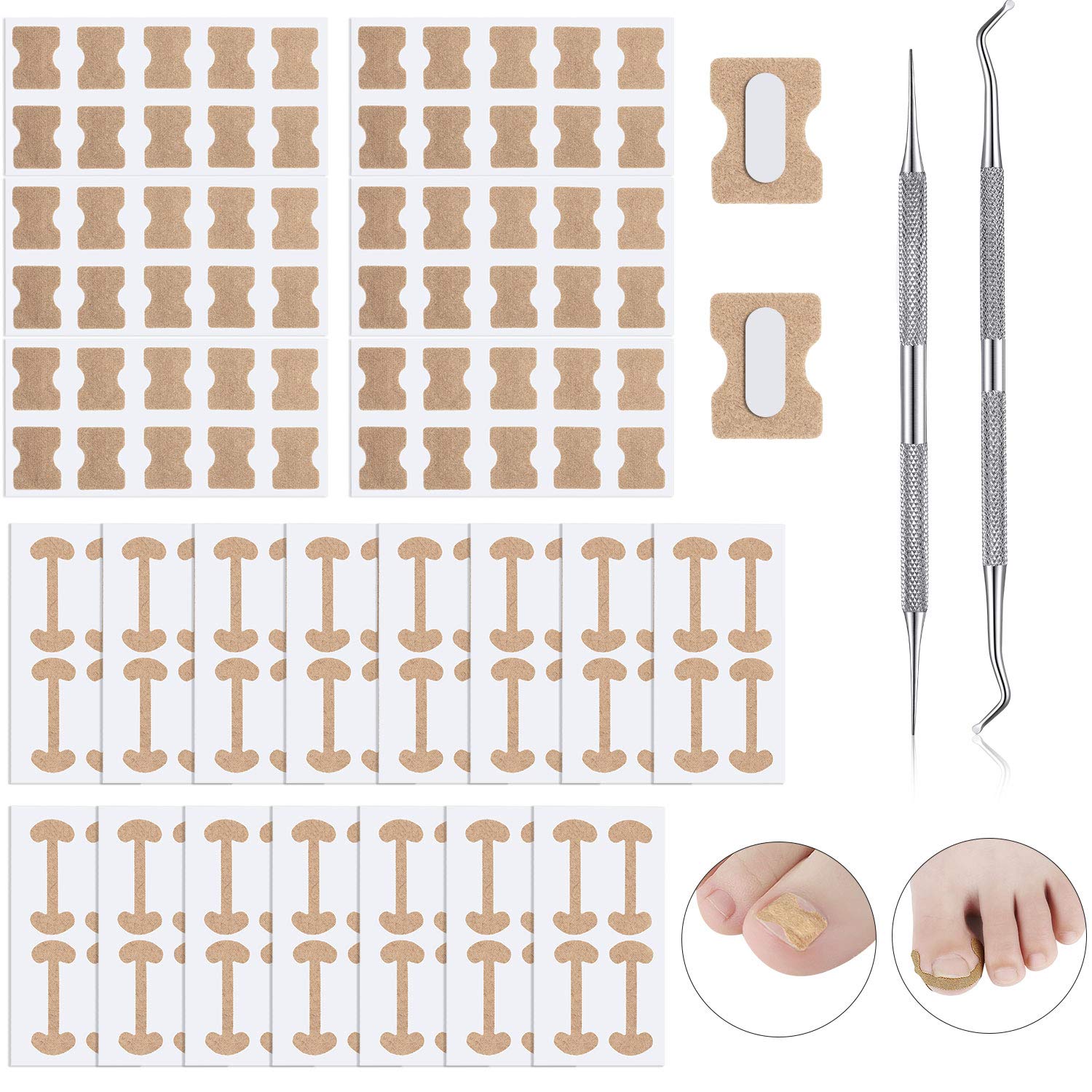 122 Pieces Ingrown Toenail Tool Set, Include Ingrown Toenail File and Lifter, 60 Pieces Elastic Patch Curved Toenails Brace Stickers and 60 Pieces Ingrown Toenail Correction Stickers: Beauty
