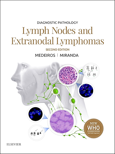 Download Diagnostic Pathology: Lymph Nodes and Extranodal Lymphomas E-Book (English Edition) PDF