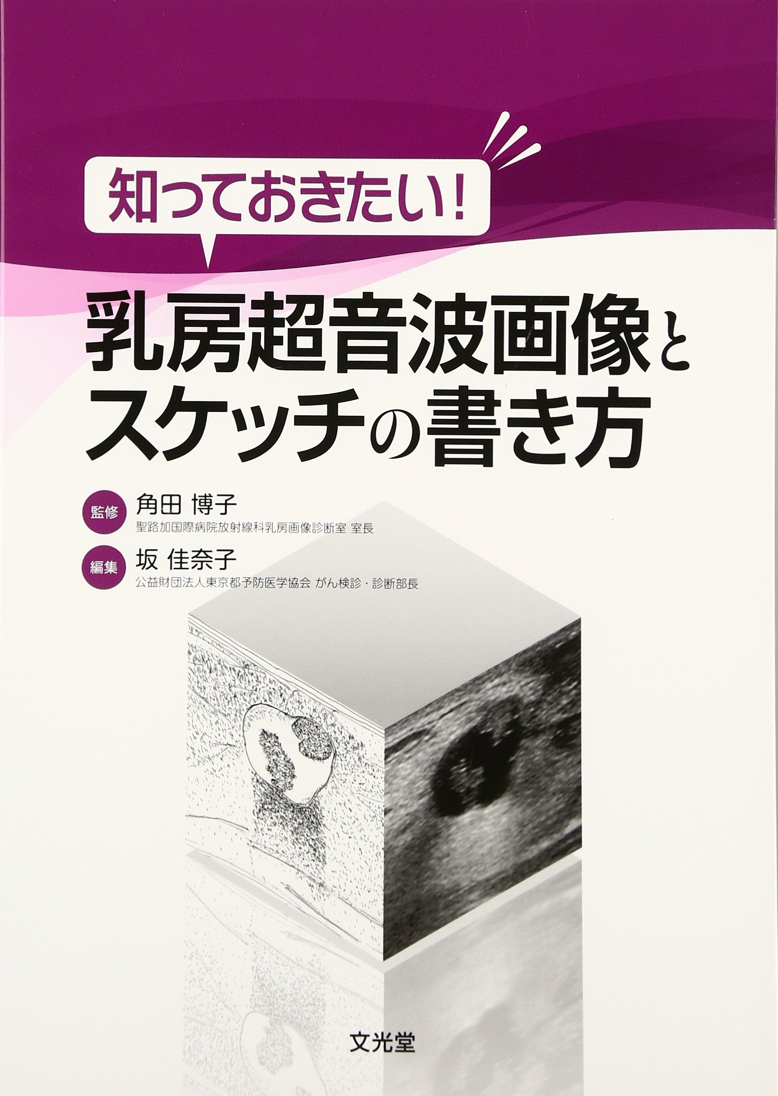 知っておきたい 乳房超音波画像とスケッチの書き方 博子 角田 佳奈子 坂 本 通販 Amazon