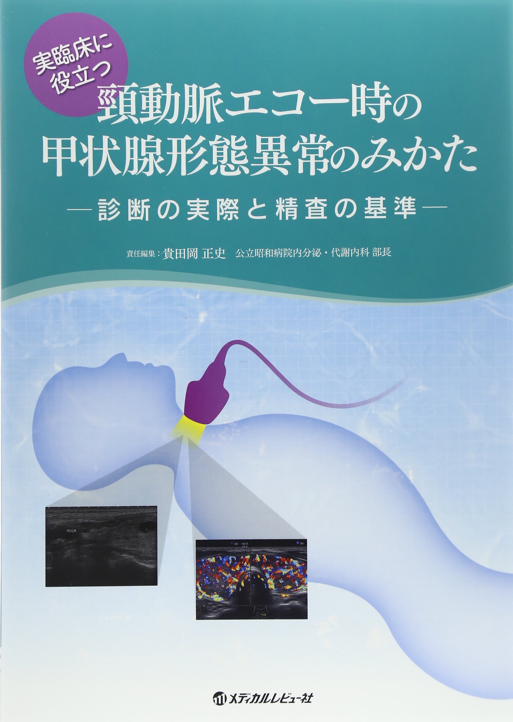 実臨床に役立つ頸動脈エコー時の甲状腺形態異常のみかた 診断の実際と精査の基準 貴田岡 正史 本 通販 Amazon