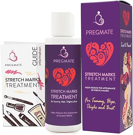 best ingredients to prevent stretch marks