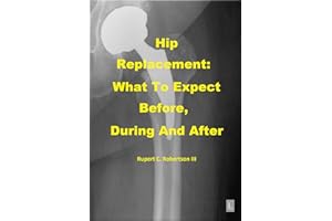 Hip Replacement: What To Expect Before, During and After