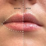 The INKEY List Plump It Up Lip Balm Duo 20ml Tripeptide Tinted Hydration Vegan view 3