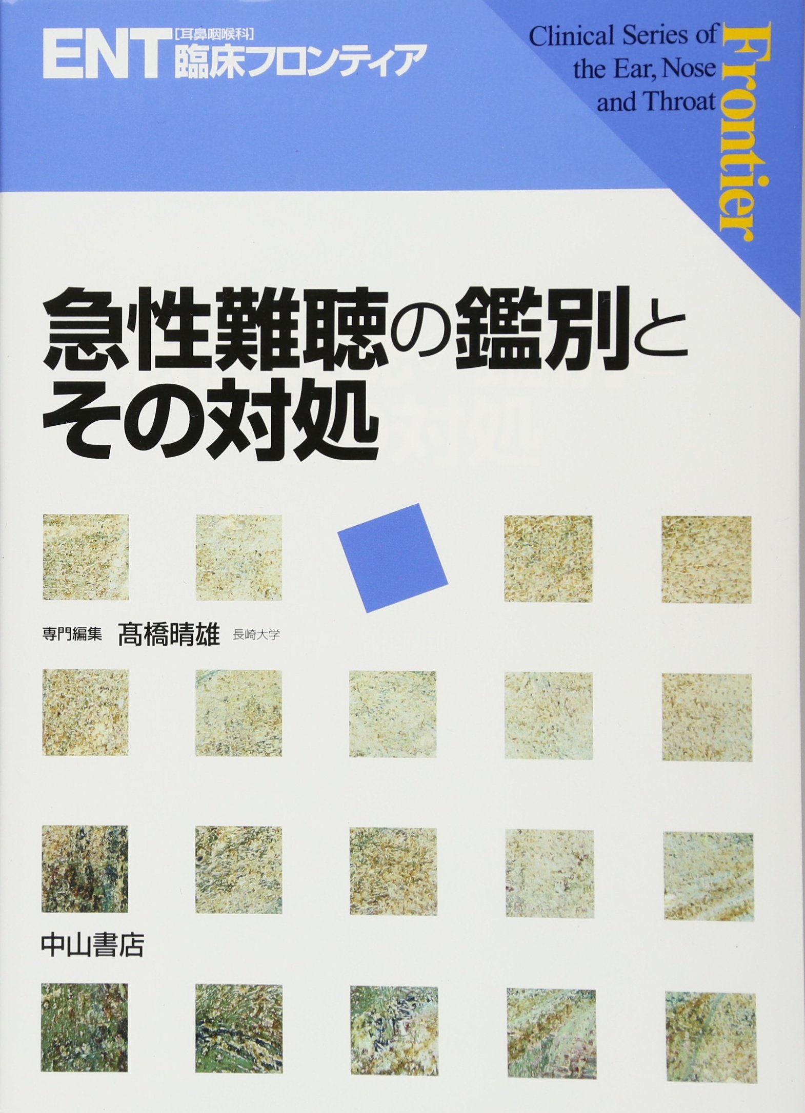 急性難聴の鑑別とその対処 Ent臨床フロンティア 橋晴雄 小林俊光 浦野正美 本 通販 Amazon