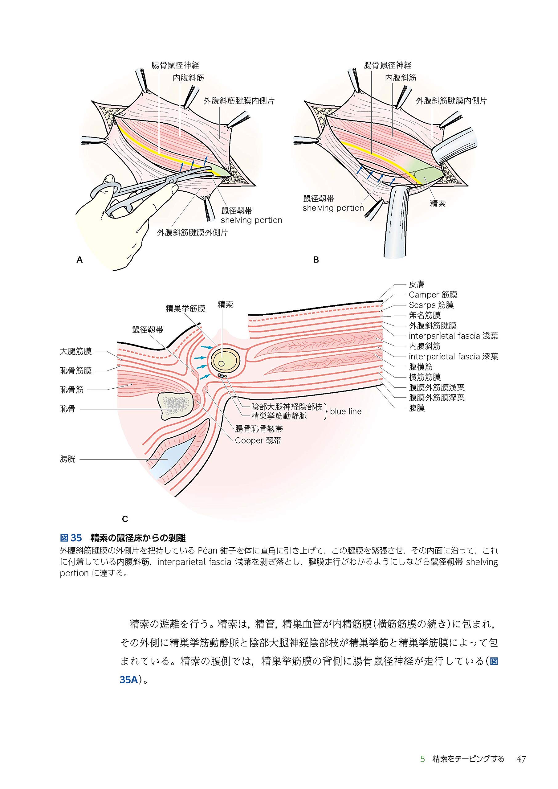 外科基本手技とエビデンスからときほぐす レジデントのためのヘルニア手術 三毛 牧夫 本 通販 Amazon