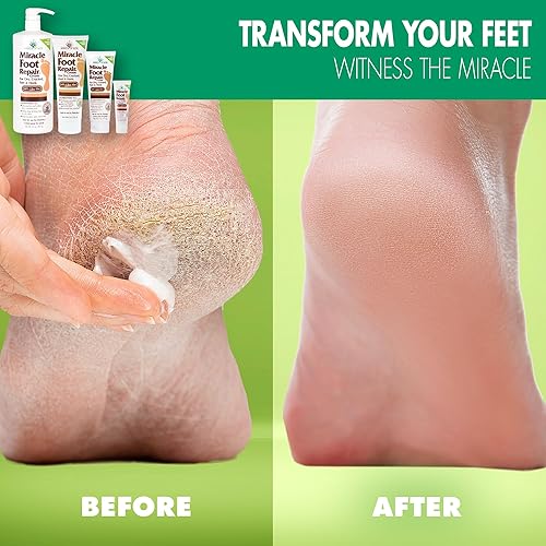 Miracle Foot Repair Cream (8 oz) Repairs Dry Cracked Heels and