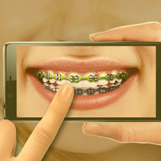 Braces Teeth .Editor