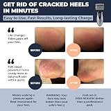 Own Harmony Electric Hard Skin Remover Rechargeable Callus Remover view 2