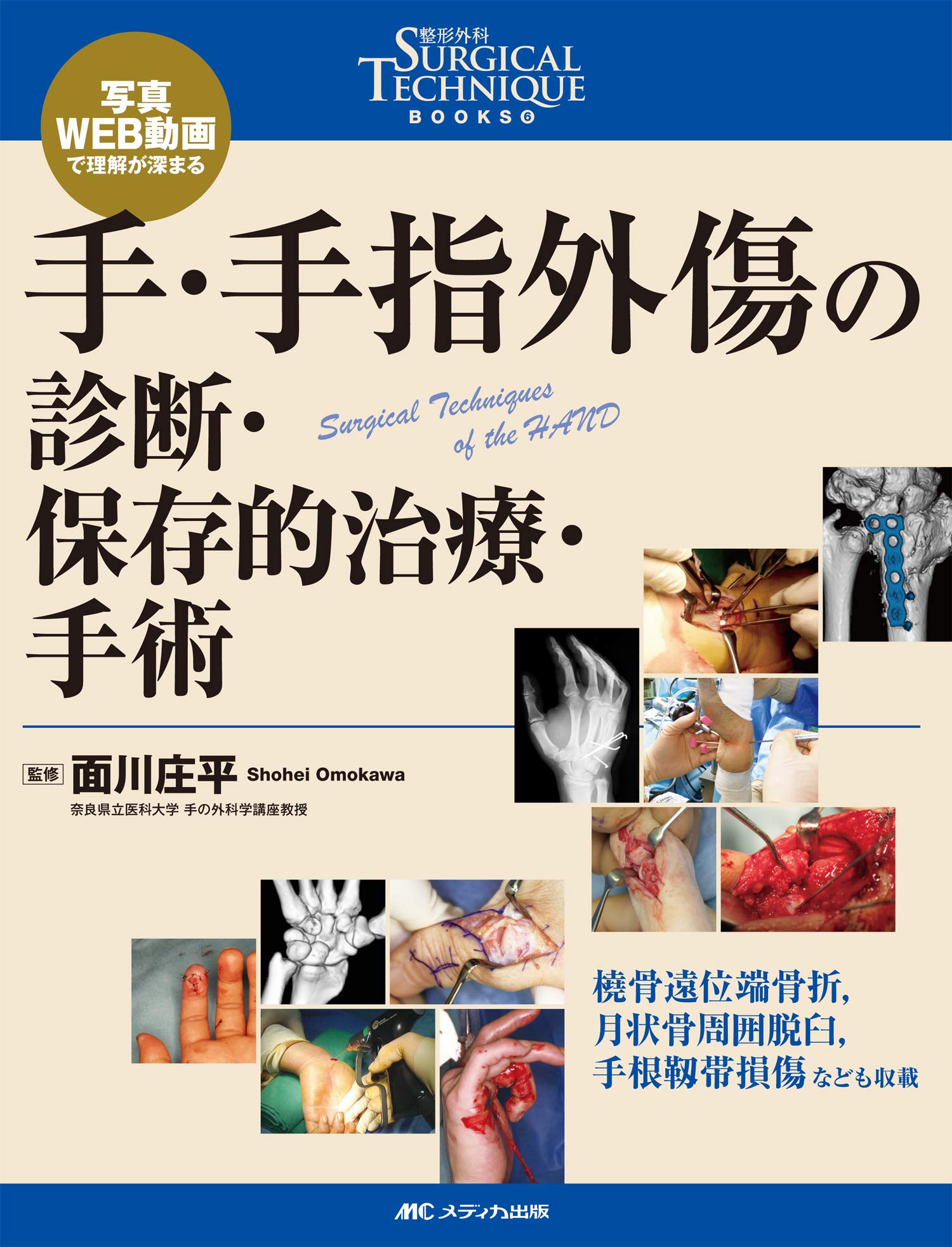 手 手指外傷の診断 保存的治療 手術 写真 Web動画で理解が深まる 整形外科surgical Technique Books 6 面川 庄平 本 通販 Amazon
