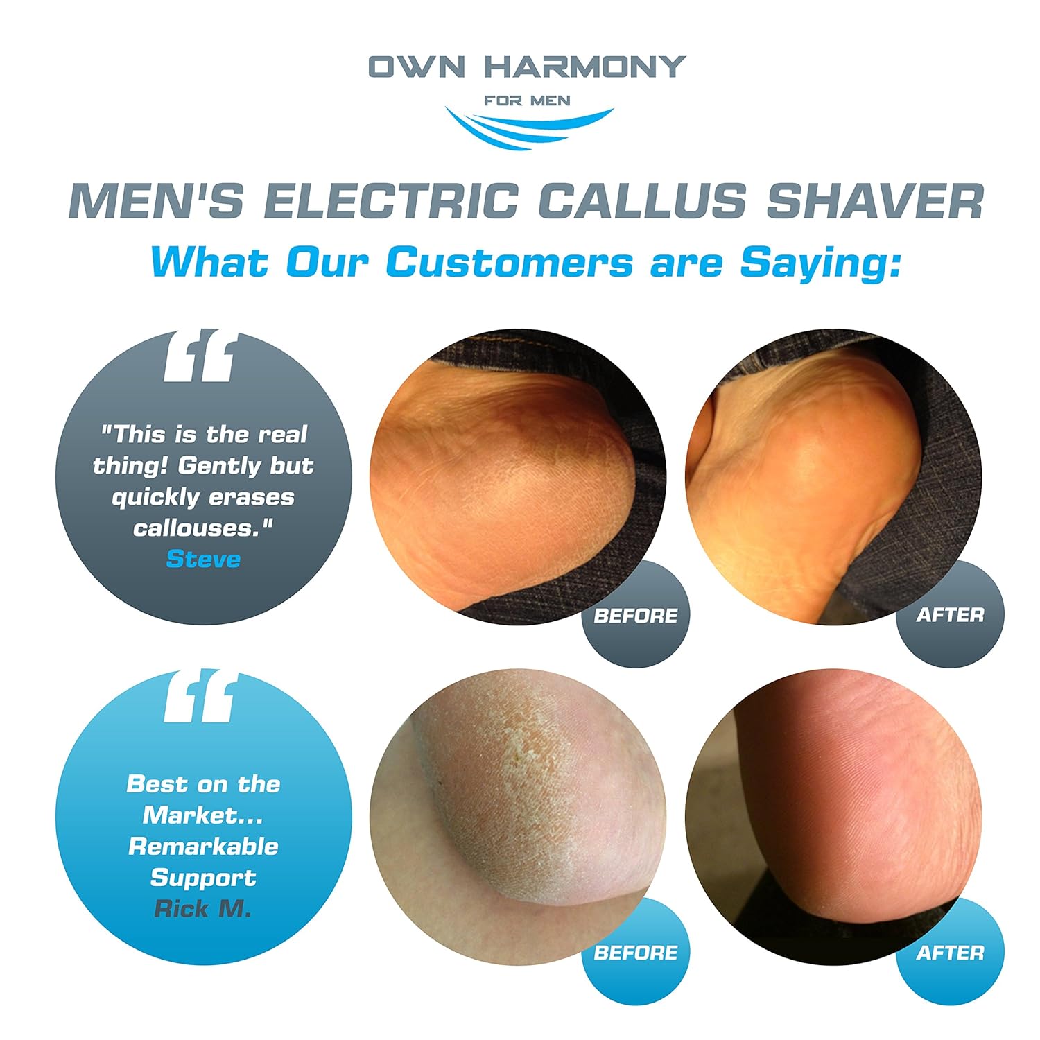 Electric Foot Callus Remover: Rechargeable Pedicure Tools for Men by Own Harmony -3 Rollers (Powerful) Best Professional Spa Electronic Micro Pedi Feet File Care Perfect for Hard Cracked Skin : Beauty