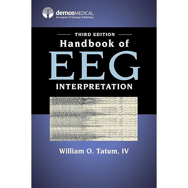 Practical Approach to Electroencephalography [ハードカバー] Libenson MD，Mark H. Practical Approach to by: Mark H. Libenson