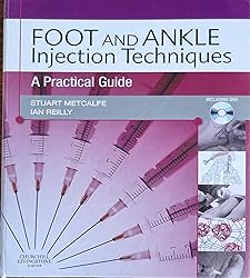Foot and Ankle Injection Techniques: A Practical