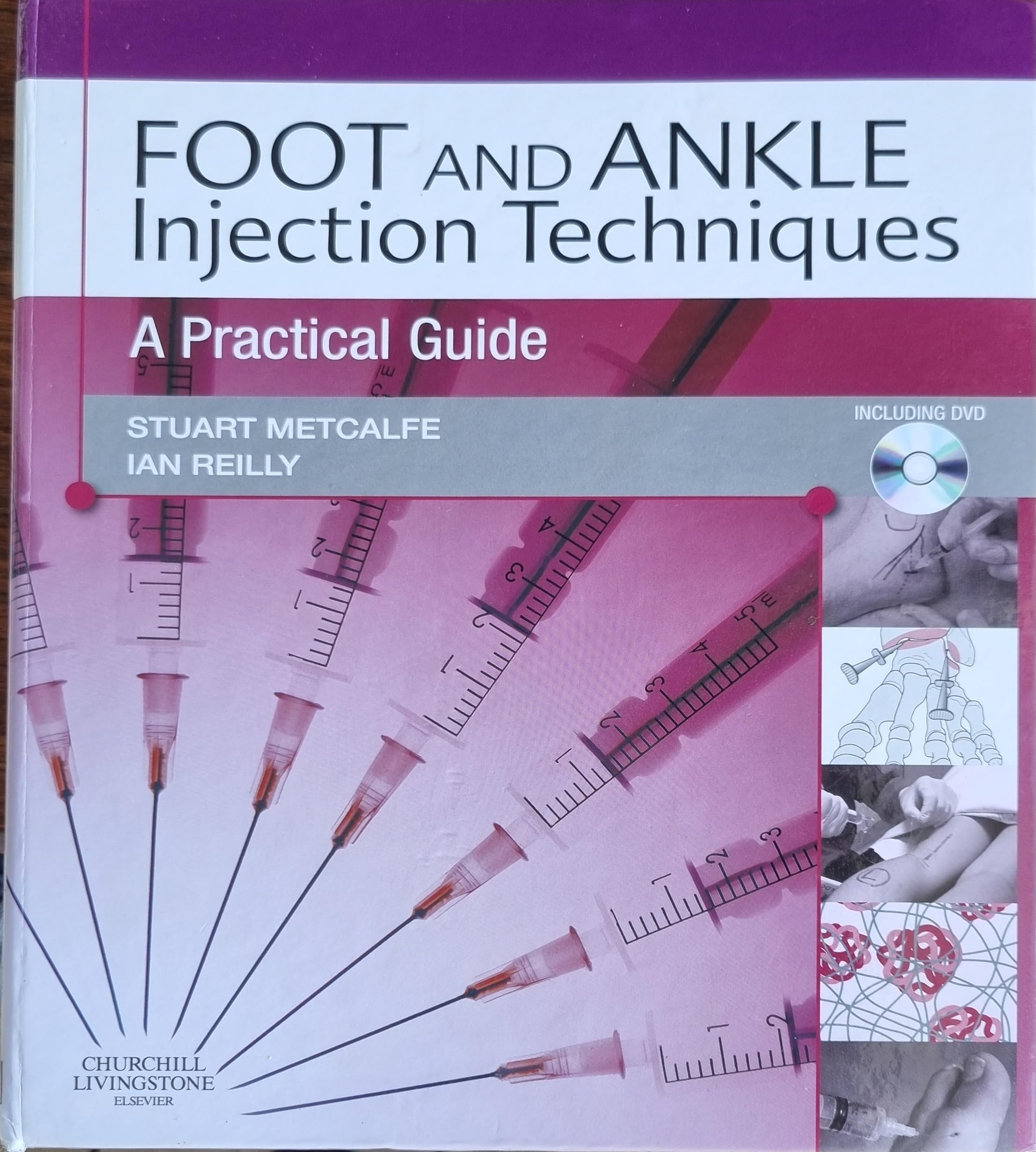 Foot and Ankle Injection Techniques: A Practical