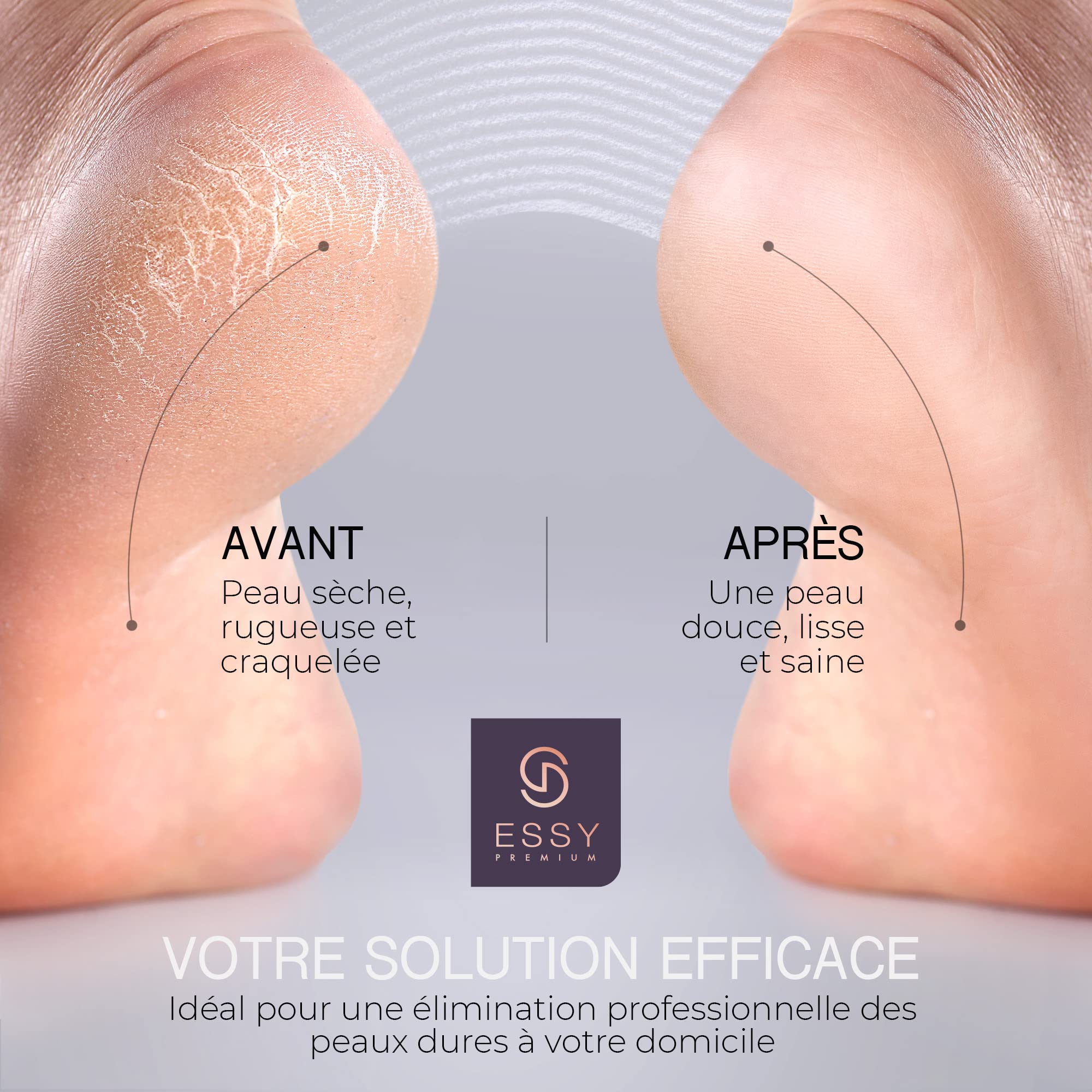Lime à Pieds Électrique avec 5 Rouleaux de Rechange (Violette)