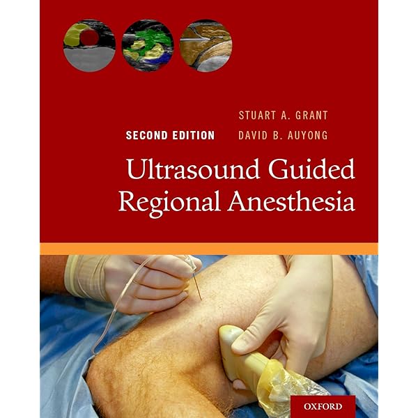 健康・医学 Hadzic's TEXTBOOK OF Regional Anesthesia Amazon.com: Hadzic's Textbook of Regional Anesthesia and