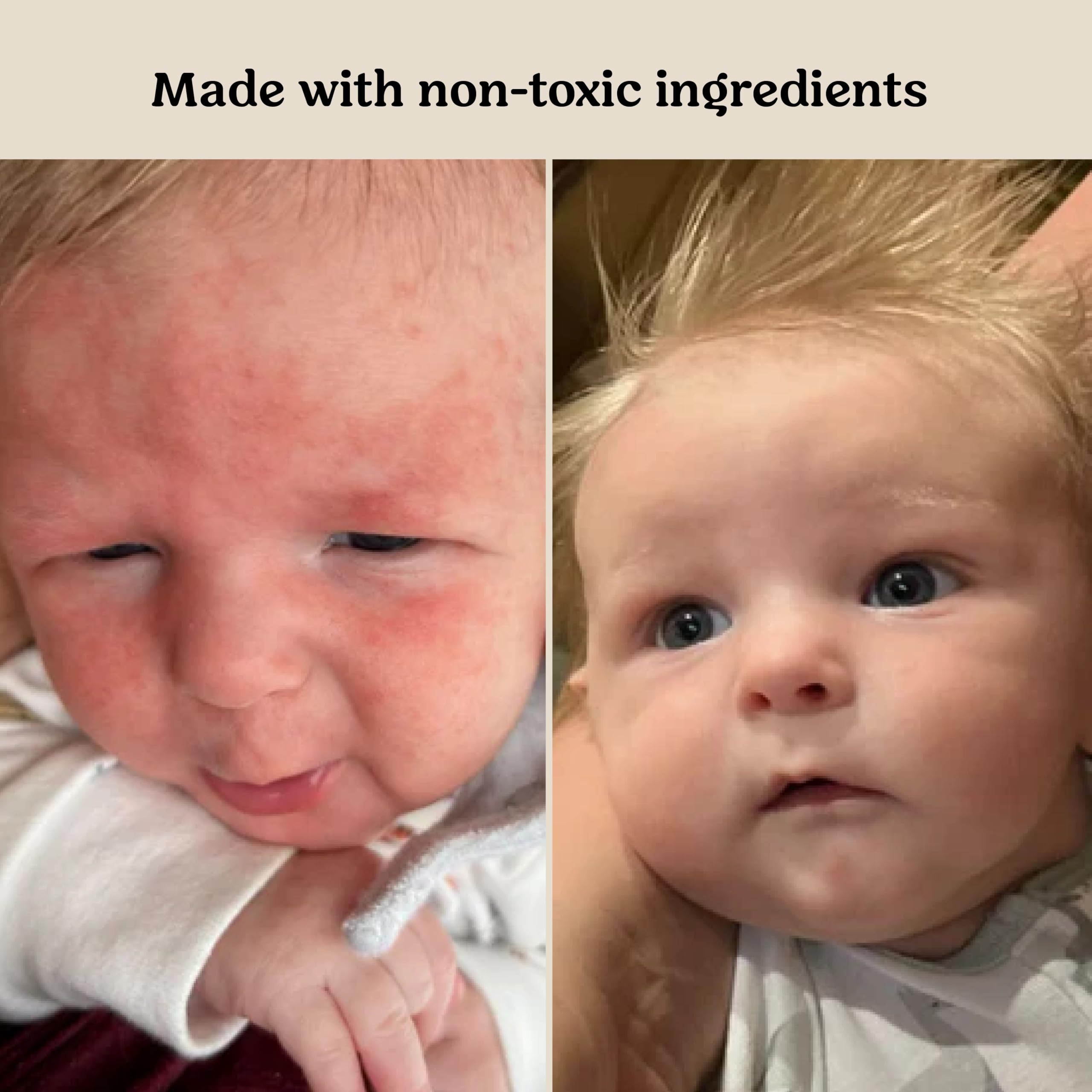 Roe Wellness- Baby Cream Lotion Ointment EWG Verified Non-Toxic Ingredients | Full Body Biome Barrier | Dry Skin, Itch Relief, Moisturizing, All Over Ointment | Toddlers & Kids