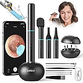 Bebird M9 Ear Care Wax Removal Tool Camera Cleaning Kit- Wireless Cleaner Ear Viewing Scope OTO-Scope with Camera & Light - V