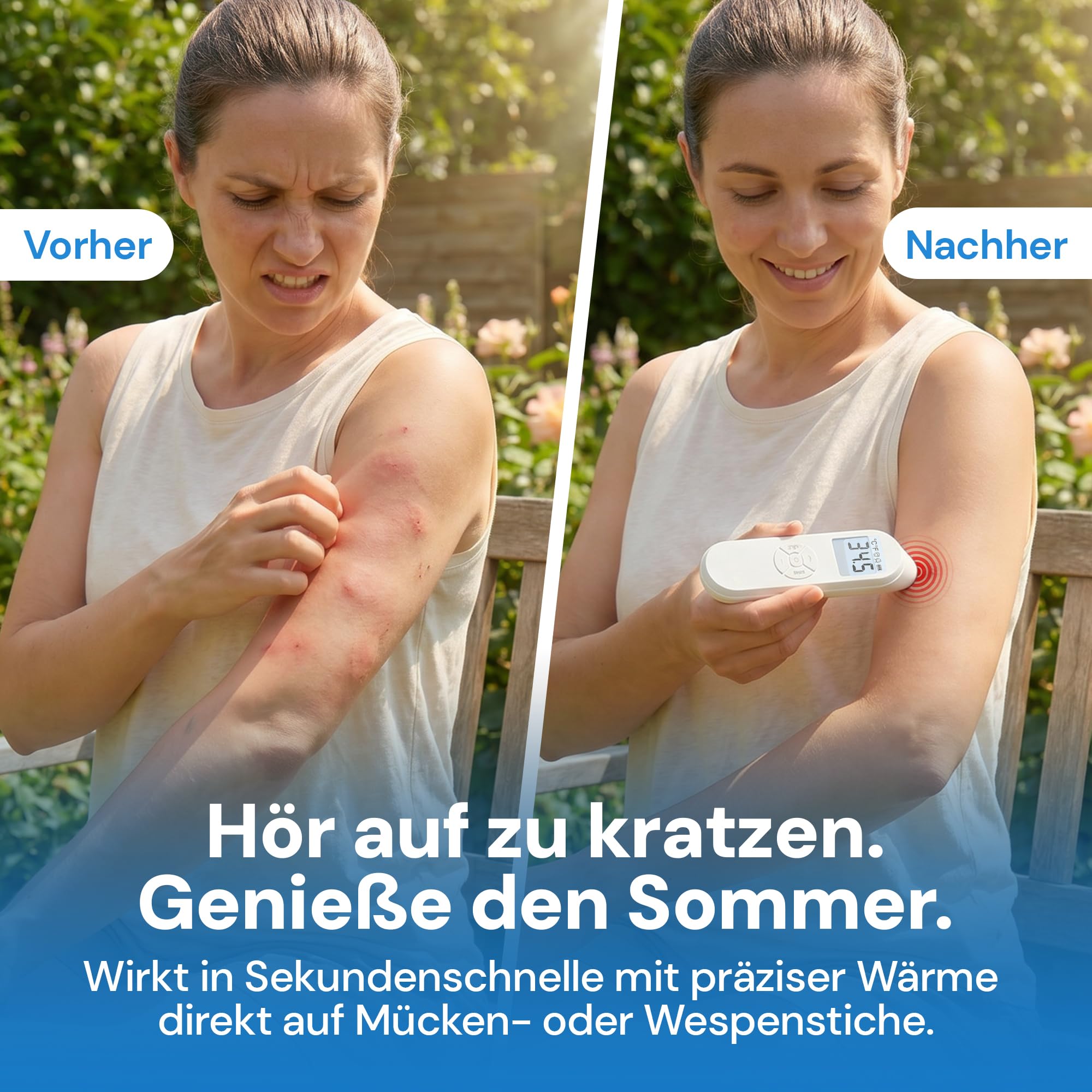 UPSHELL Mückenstich Hitzestift - Elektrischer Insektenstichheiler gegen Mücken- & Insektenstiche, LCD-Display, 30-55°C, USB-C, Kinder & Erwachsene 3