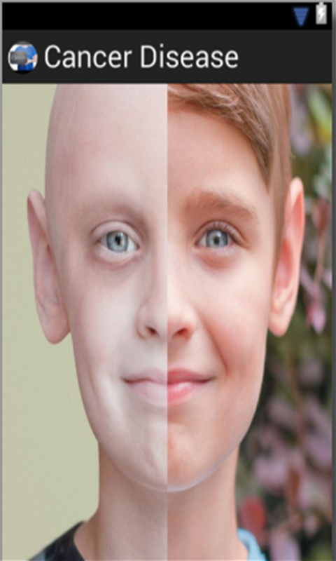 Cancer Disease - //medicalbooks.filipinodoctors.org