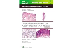 Biopsy Interpretation of the Gastrointestinal Tract Mucosa Volume 1: Non-Neoplastic: Print + eBook with Multimedia (Volume 1)