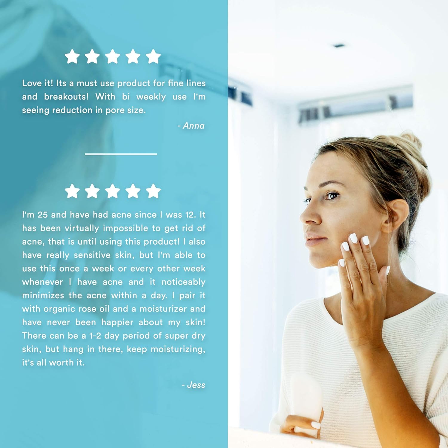 Glycolic Acid 50% Gel Peel - Enhanced with Retinol & Green Tea Extract (Professional Skin Peel)1 ounce: Beauty