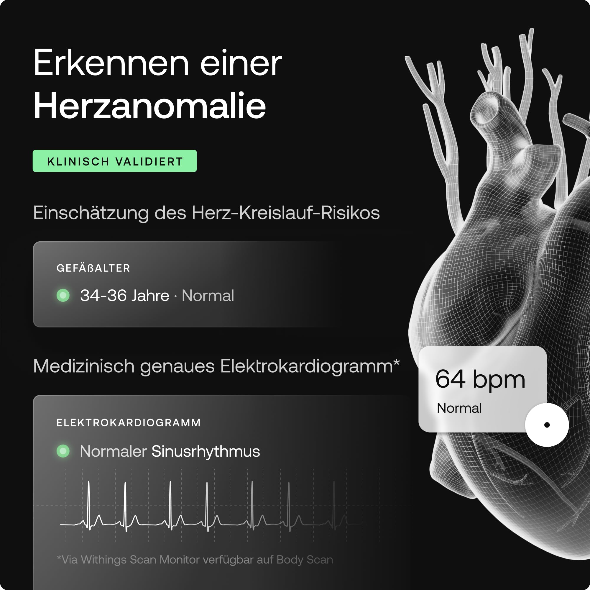 WITHINGS Body Scan - Vernetzte WLAN-Waage zur Verbesserung Ihrer Gesundheit, BIA-Personenwaage, Analyse der Körperzusammensetzung, Körperfett, Muskelmasse, Wasseranteil, Elektrokardiogramm, Schwarz 4