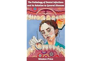 The Pathology of Dental Infections and Its Relation to General Diseases
