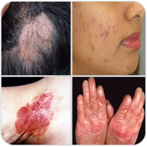 All Skin Diseases and Treatment for Android
