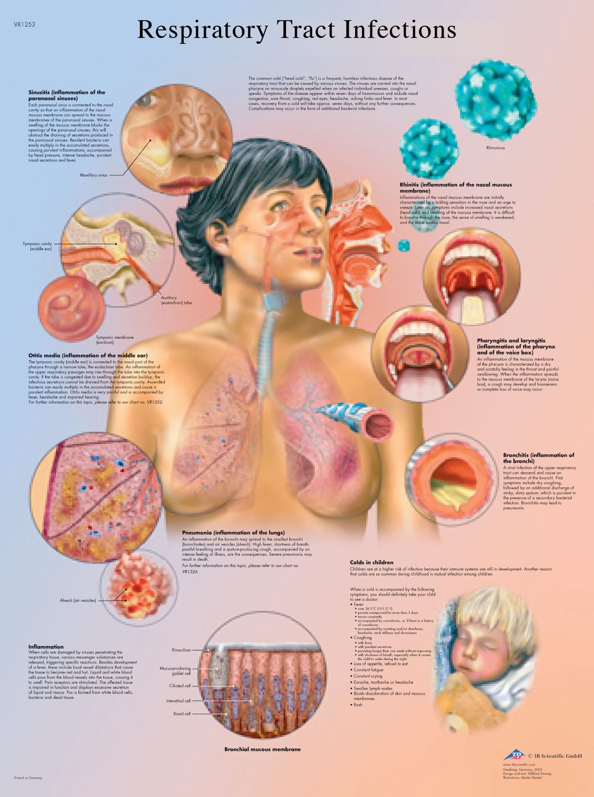 3B Scientific VR1253L Human Anatomy - Respiratory Tract Infections Chart, Laminated Version