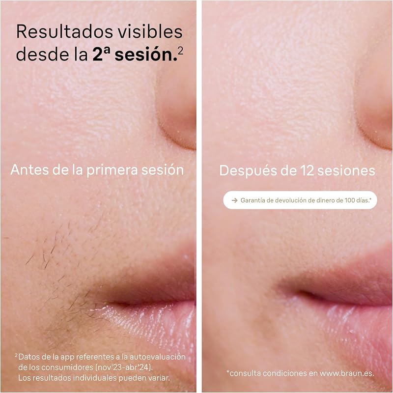 Depiladora Luz Pulsada Silk-expert Pro 5, PL5140, Blanca/Dorada