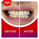 Colgate Max White Ultimate at Home LED Teeth Whitening Kit 1 Pen + LED Light view 3