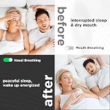 Aerate Mouth Tape for Sleeping 31 Strips White Dermatologically Tested view 6