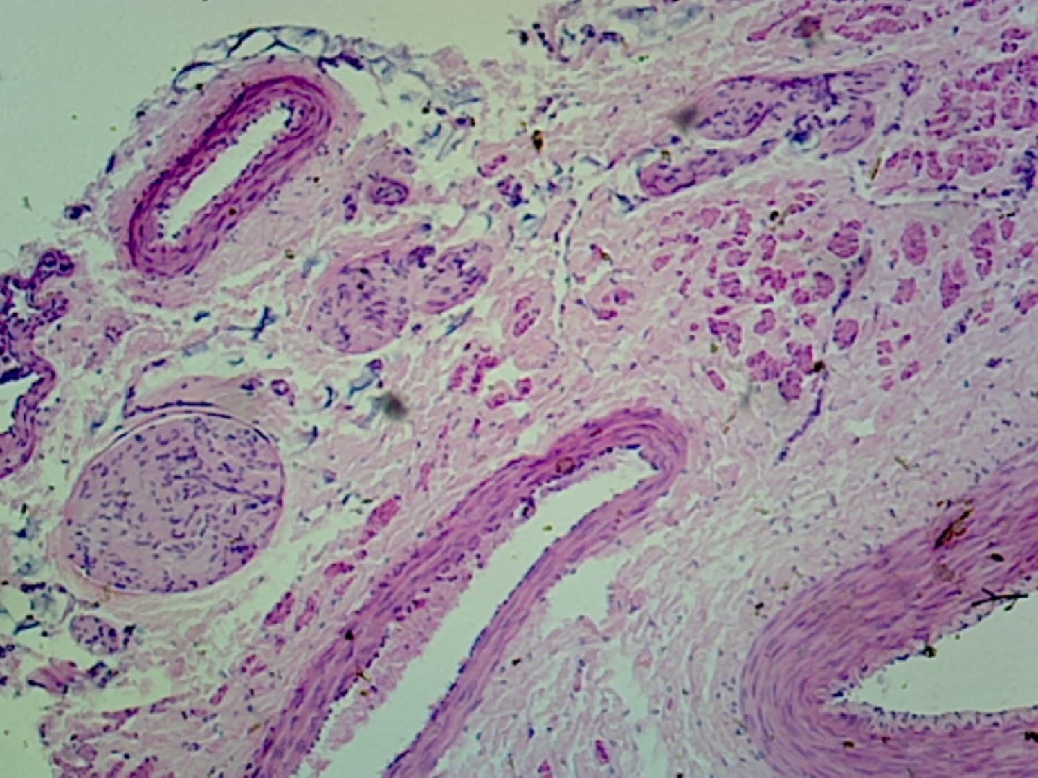 Microscope Artery And Vein - Micropedia