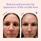 Blumbody Face Wrinkle Patches Smooth Eye Forehead Mouth Lines 30 Day Supply view 2